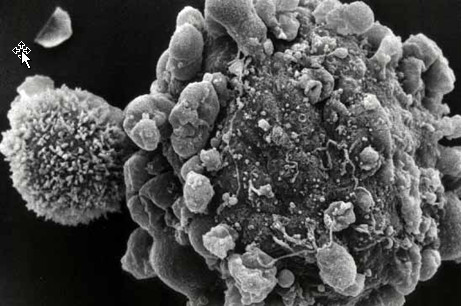 キラーT細胞が、がん細胞を攻撃